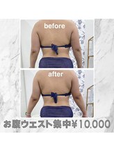 ハロ 南青山(HALO)/脂肪痩身スタンプ10P+キャビラジ