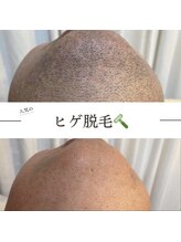 ワン(ONE)/