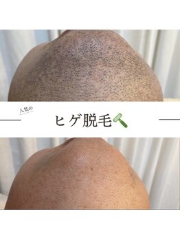 ワン(ONE)/