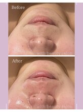 ウィズ(with)/カーボキシー×白玉WAX