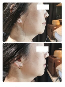 ソラ(sola*)/レモンボトル