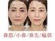 隆鼻矯正専門店 ラプリエイル 千葉店(Raplit aile)の写真