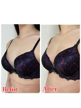 ミミー 大きさ 徹底改善