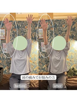 サロンドカメリア(salon de Camellia)/肩が上がりにくくてお悩みの方