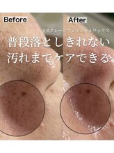 ここはな/鼻の黒ずみにフェイシャルＷＡＸ
