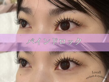 ラヴォール 天王寺(Lovall)/バインドロック100束