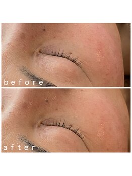 メナードフェイシャルサロン 岐阜茜部/スムースジェルパック