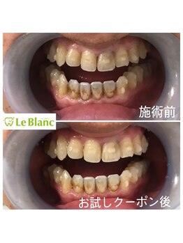 ルブラン 奈良店(Le Blanc)/歯のお悩み等