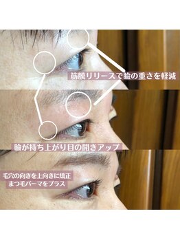 イーストアッカ アイラッシュ(East AkkA eyelash)/ダブルアイリフト