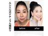 -リピーター様継続率NO1-最先端小顔術×オプションプラス1【9回券】