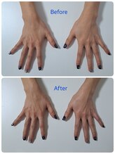 ボディーレボリューション 南福島店(Body-Revolution)/パラフィンパックBeforAfter