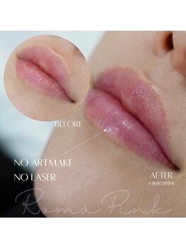 ラ クレール ビューティーサロン(LA CLAIR)/ローマピンク