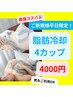 ★平日限定★【脂肪冷却】冷却4カップ30分１セット計4箇所♪【男女OK】