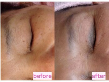 アドミーロ/お目元の黒ずみも改善★