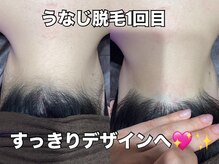 リエル(RIEL)/【うなじ脱毛】