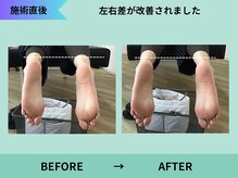 トミーリハ整体院(TOMMY REHA整体院)/左右差が改善