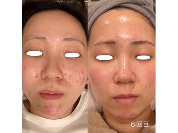 ランポ(lampo)/Lit 6回目