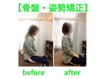 トキワ(TOKIWA)/姿勢矯正before/after