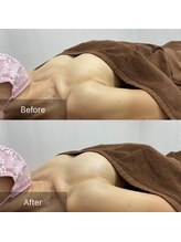 ルミエール(Lumiere)/【倉敷市】バストアップ施術事例