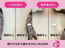 ブルーム(BLOOM)の雰囲気（右のみ施術を入れたビフォーアフター写真）