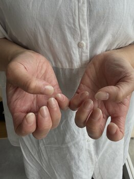 ハイク(HIKE)/【hand＊Type A】