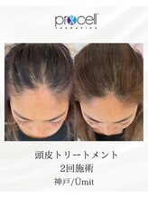 ユミト(Umit)/プロセルスカルプ