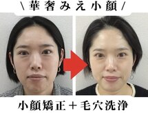 本格痩身&小顔サロンBUPURA 周南店【ブプラ】