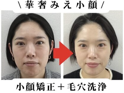 本格痩身&小顔サロンBUPURA 周南店【ブプラ】の写真