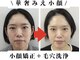 本格痩身&小顔サロンBUPURA 周南店【ブプラ】の写真