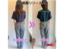 ライトワーク 西新宿店の雰囲気（ビフォー＆アフター★お悩みに合わせてしっかり結果を出します♪）