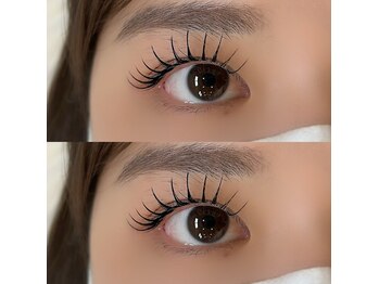 ソンテ(sonte.)/フラットラッシュ×&healthy