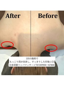 マナリンパ(Mana)/肩こり・首コリをスッキリ