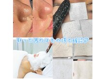 ビューティーザイオン(Beauty zion)の雰囲気（国産ハーブピーリング/ニキビ肌/肌質改善）