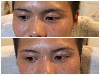 スリーピース(3Peace)/アーチ眉 Before/After