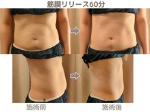 シェルサロン(Shell Salon)/ビフォーアフター