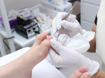 ルポ 佐倉の写真/歩くたびにつらい巻き爪のお悩みに！専門ケアで足元の不調を根本から緩和