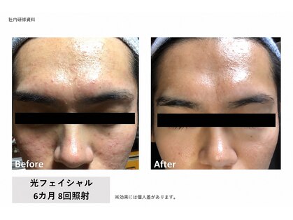 メン脱 三軒茶屋(Men脱)の写真