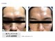メン脱 三軒茶屋(Men脱)の写真
