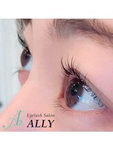 アリー(ALLY)/