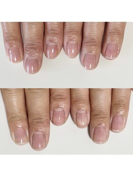 ワイドット(y.)/最強ネイルケアコース