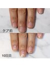 形改善【ネイルケアコース】