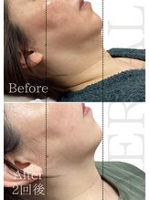 エアリアル 中津店/あご肉