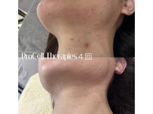 ルチル(Rutile)/プロセルセラピーズフェイシャル