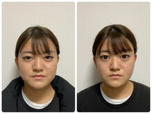 ナチュライズ(NatuRise)の雰囲気（小顔・リフトアップ・毛穴・肌のハリ・ツヤに美容鍼）