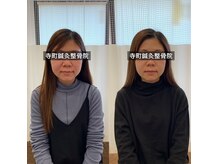 寺町鍼灸整骨院の雰囲気（リピーター続出◎ほうれい線やたるみ改善に幹細胞美容鍼）