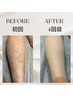 【男女OK】5箇所セレクト脱毛♪気になる部分だけ賢くケア1回￥2,980