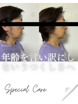 リノン(LIINON)/年齢を言い訳にしない美しさへ!