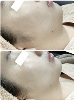 ソラ(sola*)/レモンボトル