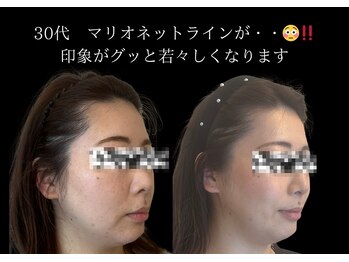 ナースセレクトサロン(Nurse select salon)/
