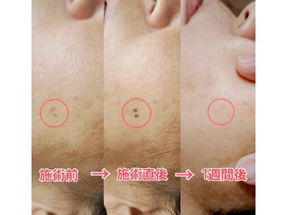 メルシー レディースアンドメンズサロン(Merci)の写真